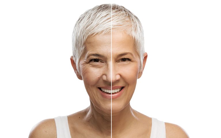 antiaging