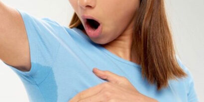 Hiperhidrosis