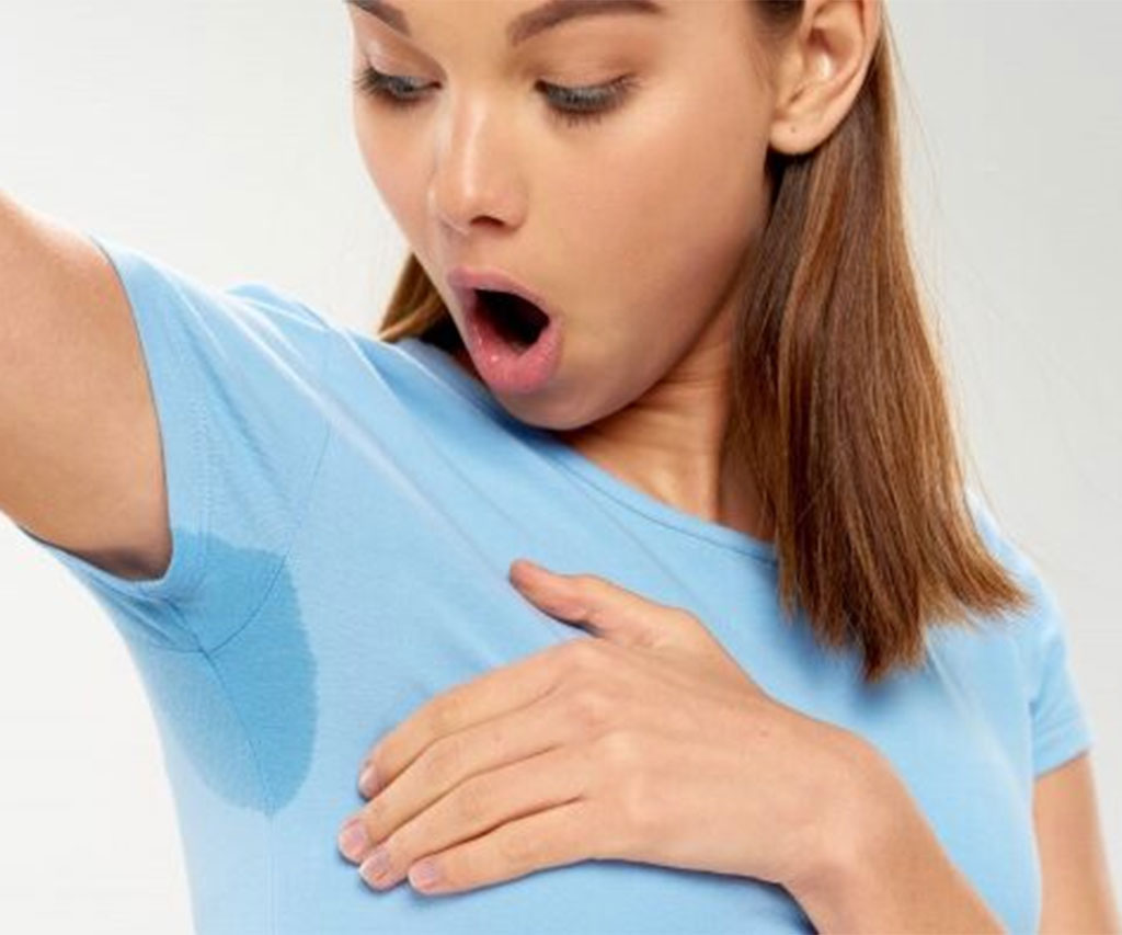 Hiperhidrosis